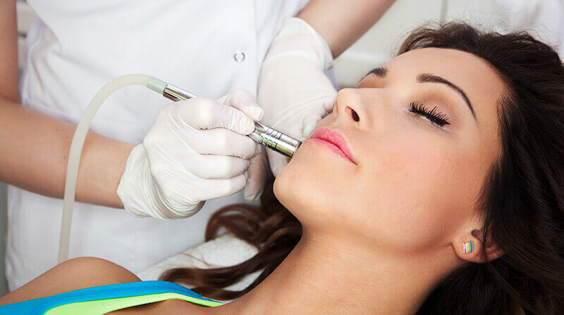 Facial laser resurfacing treatment